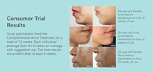 Load image into Gallery viewer, Riversol | Comprehensive Acne Treatment - Asgard Beauty
