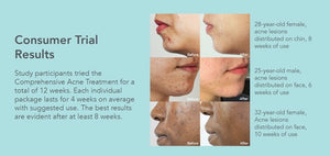Riversol | Comprehensive Acne Treatment - Asgard Beauty